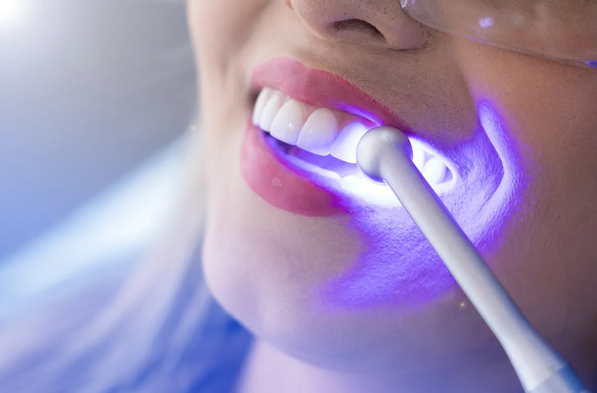 Odonto Company — Odontologia em Itatiba em Itatiba