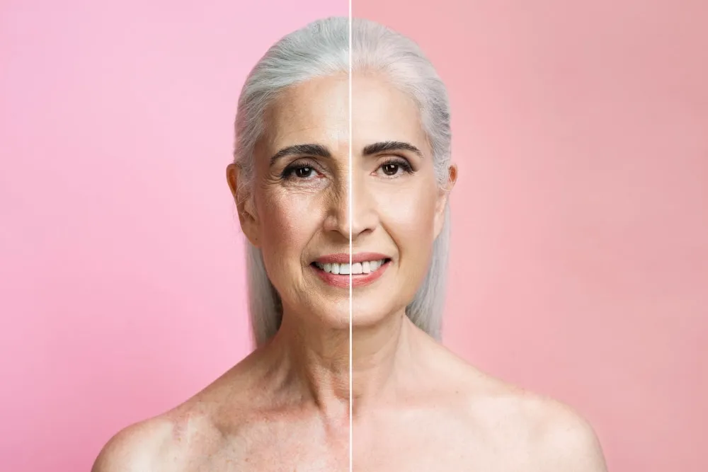 Bioface — Estética Avançada em Itatiba em Itatiba