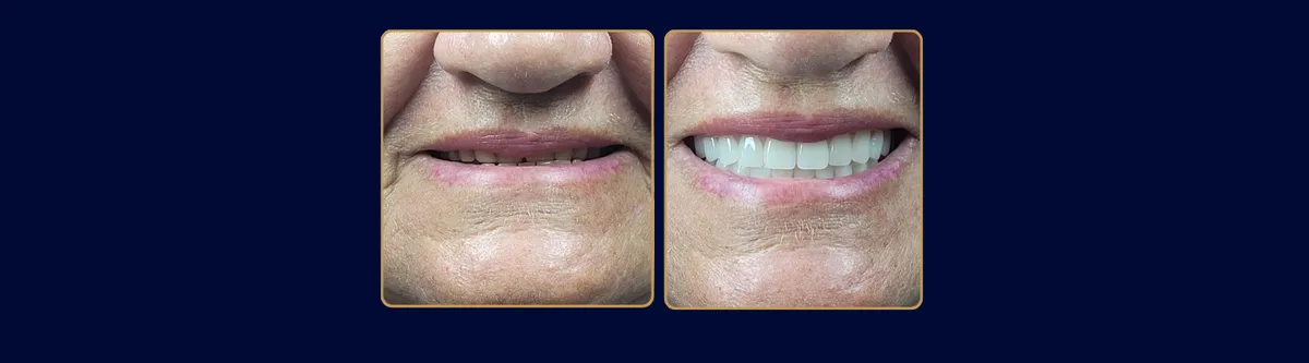 Dra. Grazi Silva — Odontologia em Itatiba em Itatiba
