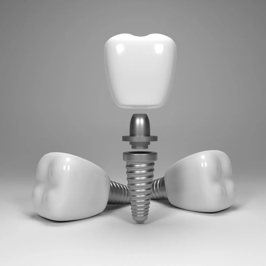 Aline Tavares Odontologia — Odontologia em Itatiba em Itatiba