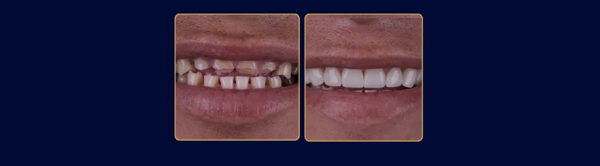 Tatiana Bisetto Casarin — Odontologia em Itatiba em Itatiba